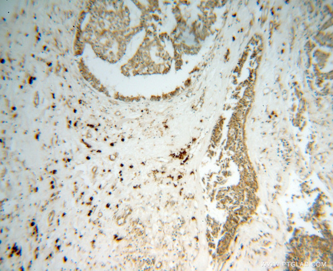 GRP94 Antibody in Immunohistochemistry (Paraffin) (IHC (P))