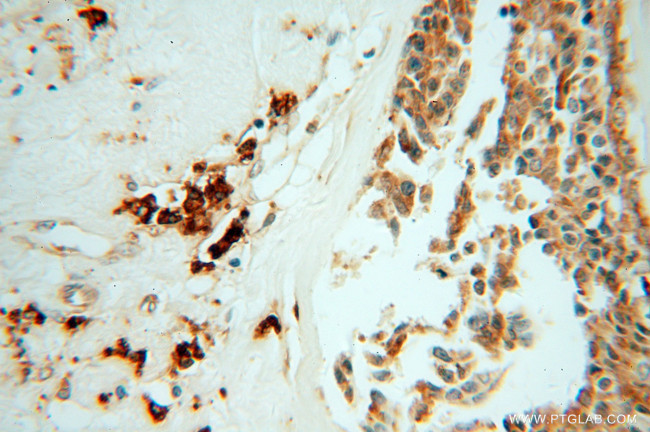 GRP94 Antibody in Immunohistochemistry (Paraffin) (IHC (P))