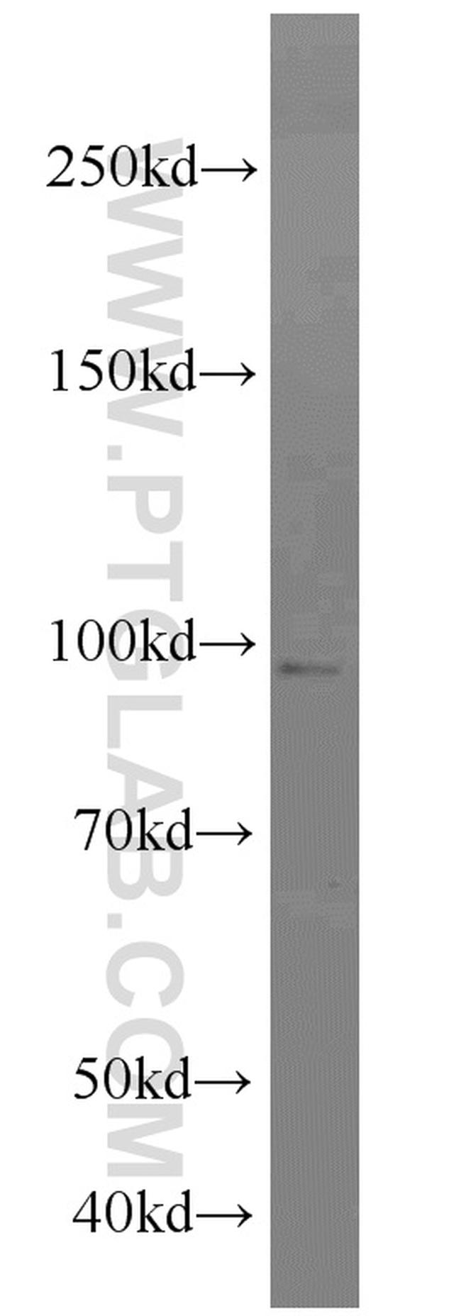 GRP94 Antibody in Western Blot (WB)