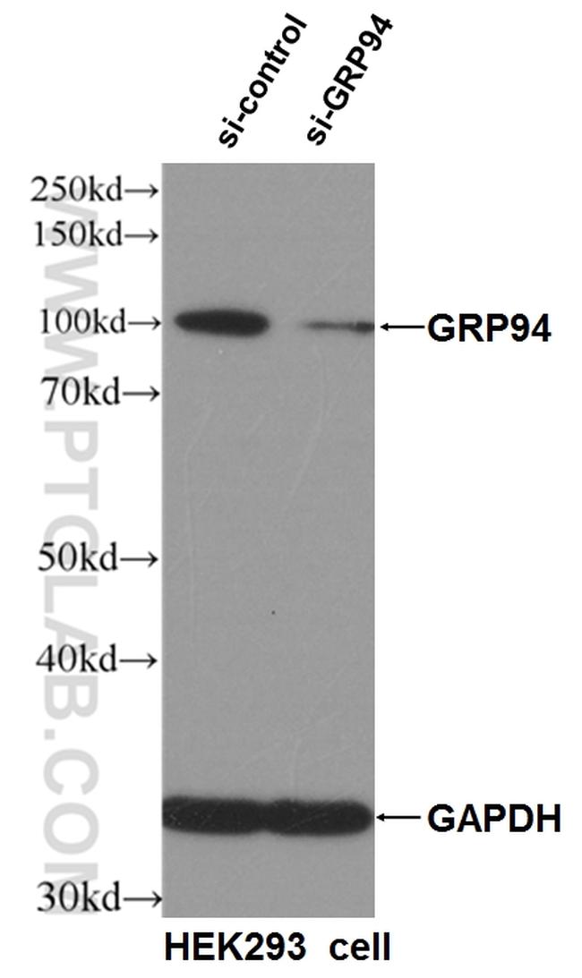 GRP94 Antibody in Western Blot (WB)