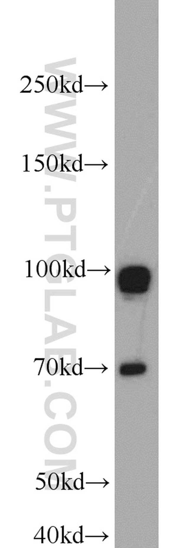 GRP94 Antibody in Western Blot (WB)