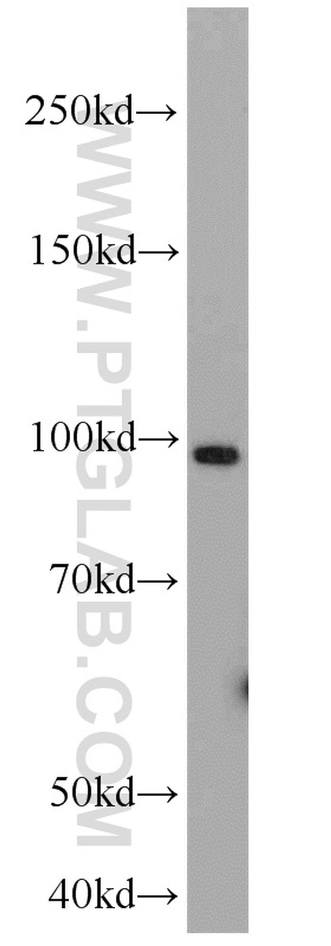 GRP94 Antibody in Western Blot (WB)