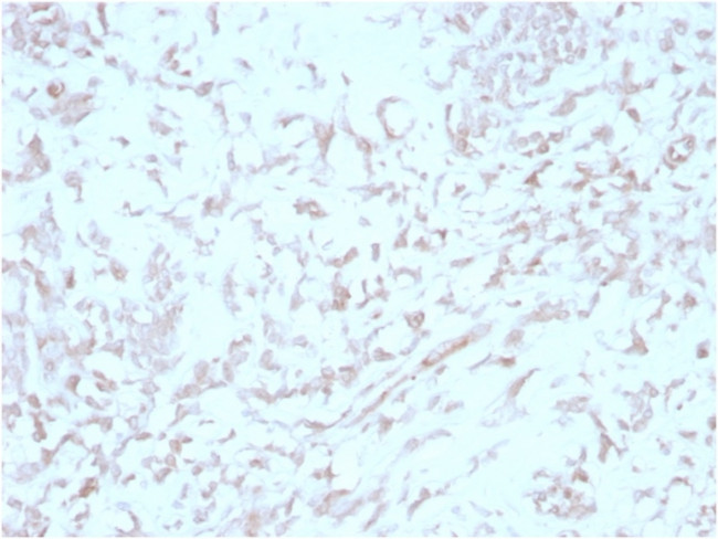 Kindlin-2/KIND2 Antibody in Immunohistochemistry (Paraffin) (IHC (P))