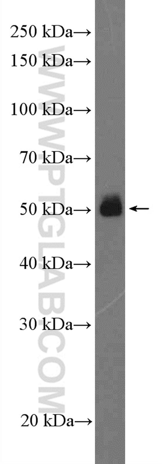 Fc epsilon RI alpha Antibody in Western Blot (WB)