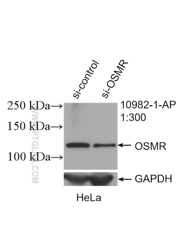 OSMR Antibody in Western Blot (WB)