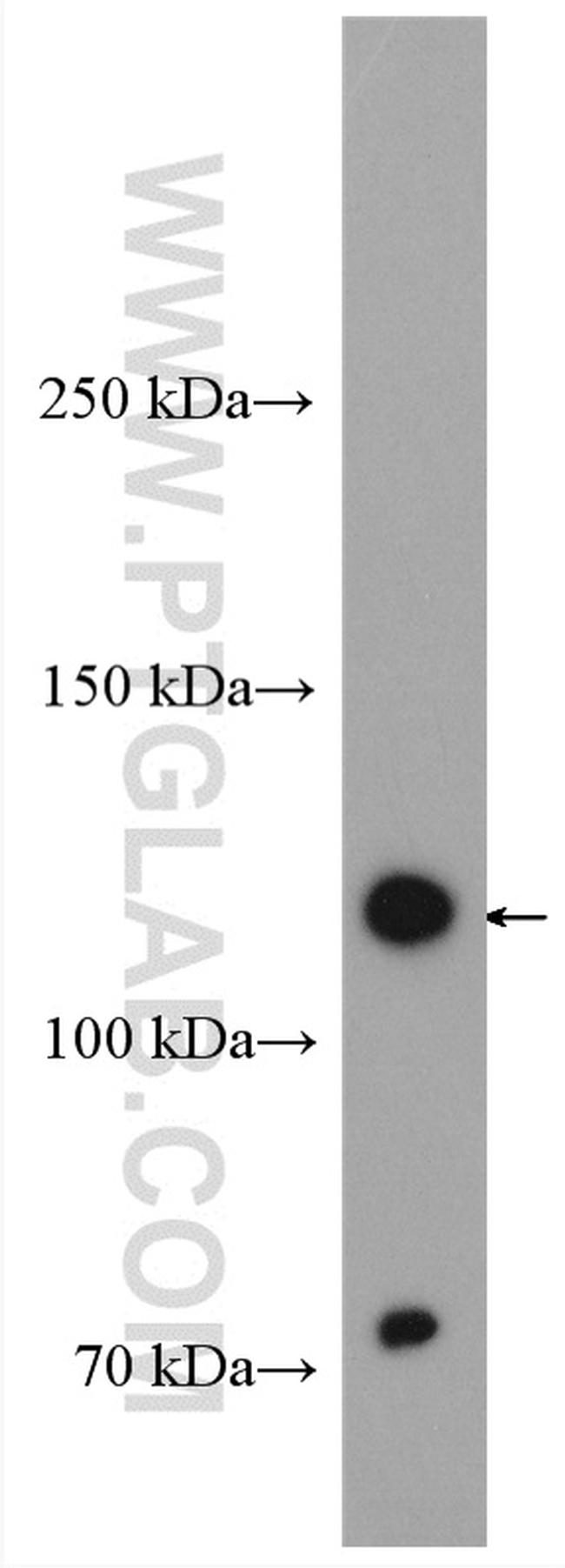 OSMR Antibody in Western Blot (WB)