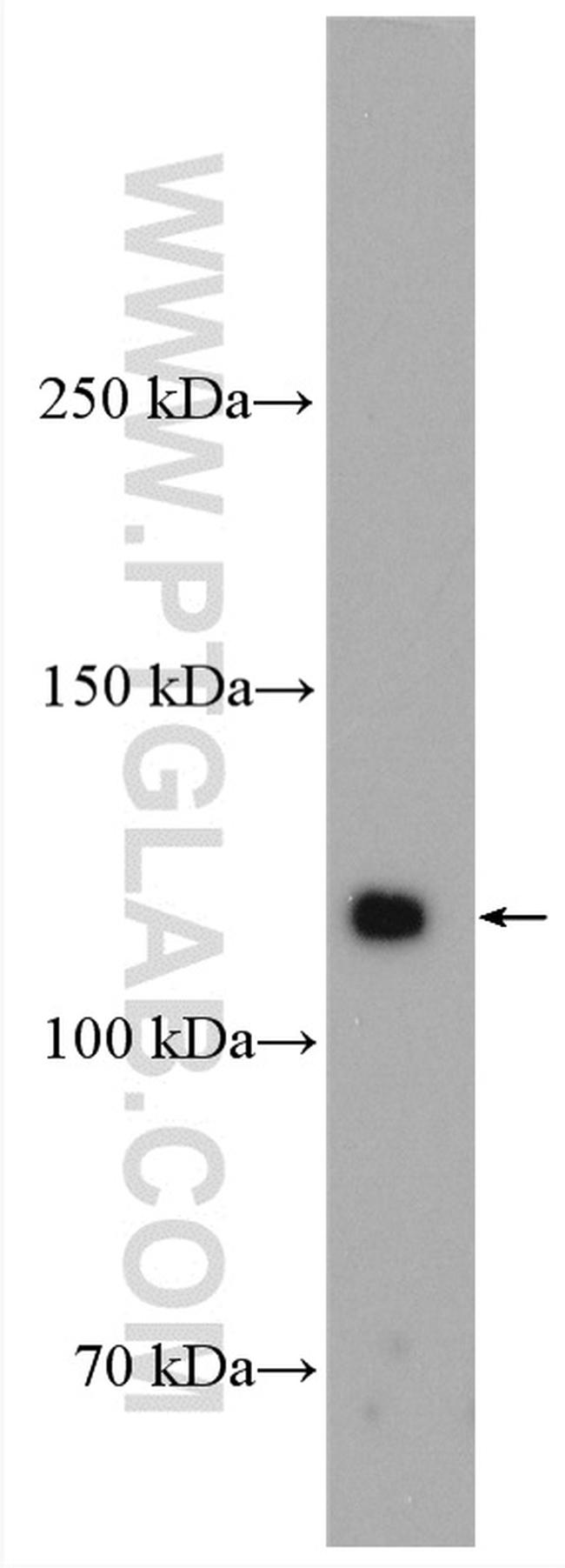 OSMR Antibody in Western Blot (WB)