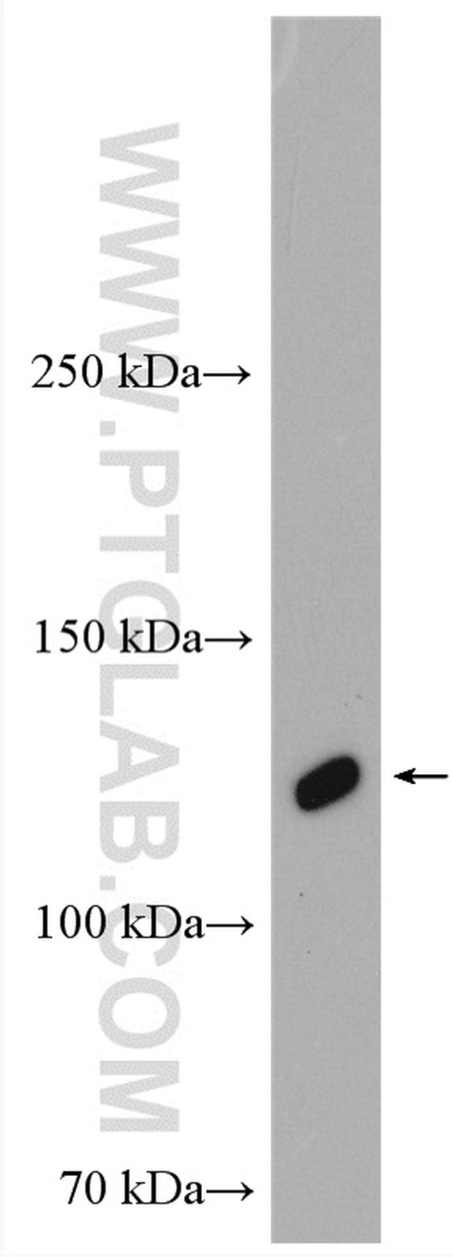 OSMR Antibody in Western Blot (WB)