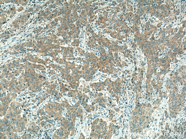 PICK1 Antibody in Immunohistochemistry (Paraffin) (IHC (P))