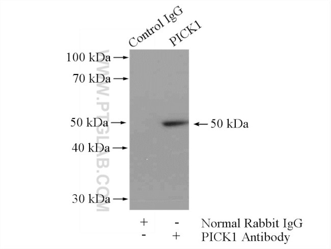 PICK1 Antibody in Immunoprecipitation (IP)