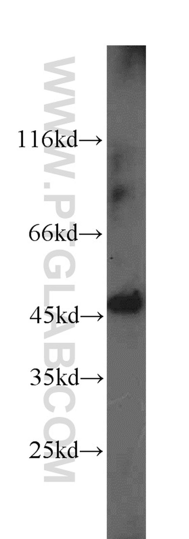 PICK1 Antibody in Western Blot (WB)