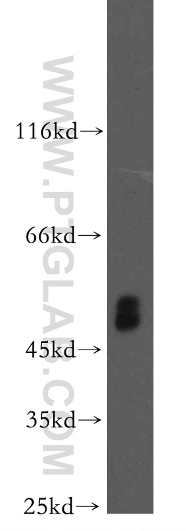 PICK1 Antibody in Western Blot (WB)