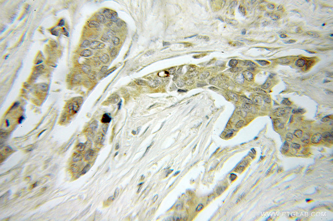 MRPS22 Antibody in Immunohistochemistry (Paraffin) (IHC (P))