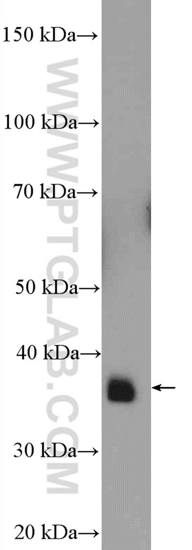 MRPS22 Antibody in Western Blot (WB)