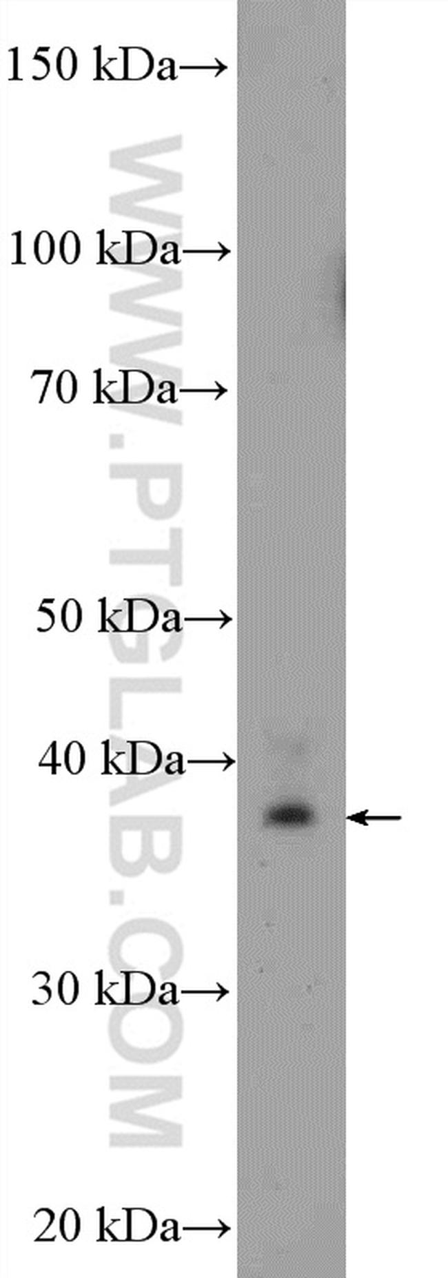 MRPS22 Antibody in Western Blot (WB)