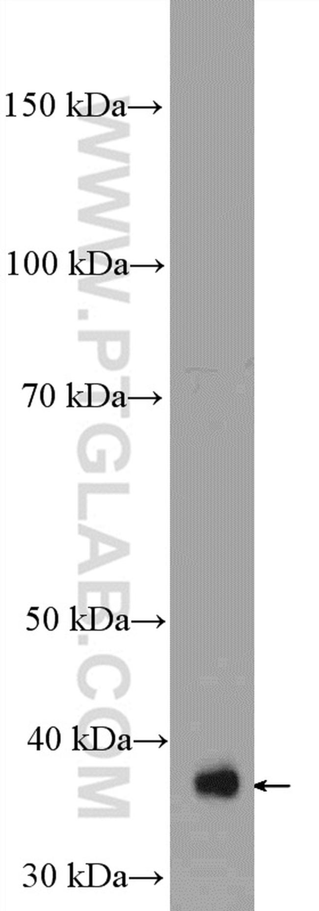 MRPS22 Antibody in Western Blot (WB)