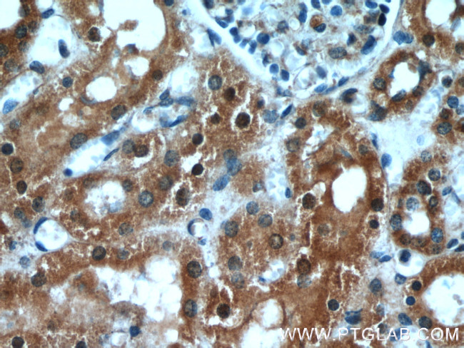 GRIM19 Antibody in Immunohistochemistry (Paraffin) (IHC (P))