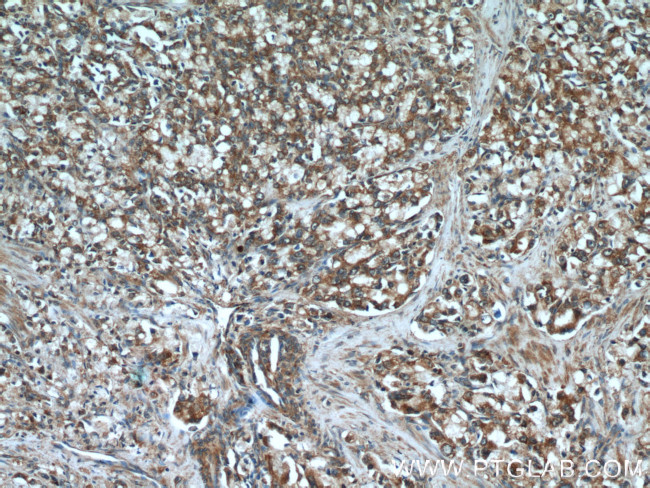 GRIM19 Antibody in Immunohistochemistry (Paraffin) (IHC (P))