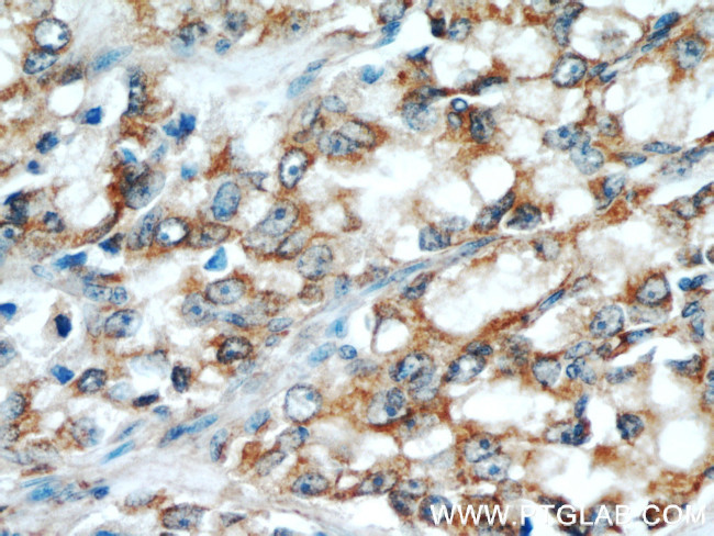 GRIM19 Antibody in Immunohistochemistry (Paraffin) (IHC (P))