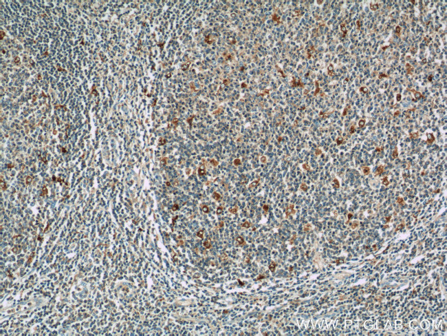 WASP Antibody in Immunohistochemistry (Paraffin) (IHC (P))