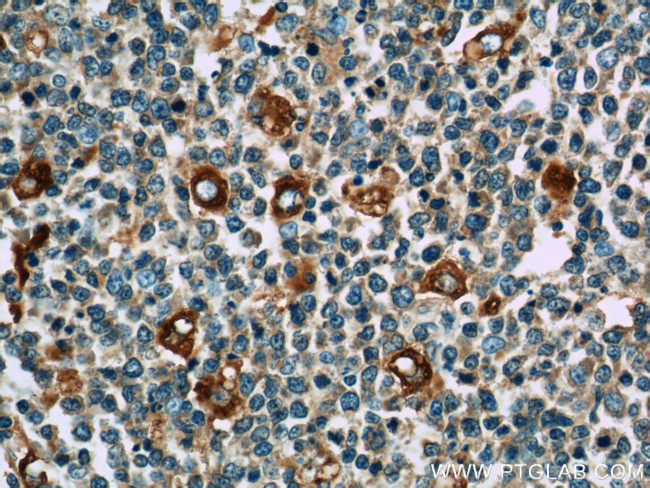 WASP Antibody in Immunohistochemistry (Paraffin) (IHC (P))