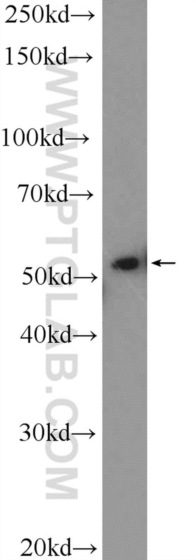 WASP Antibody in Western Blot (WB)