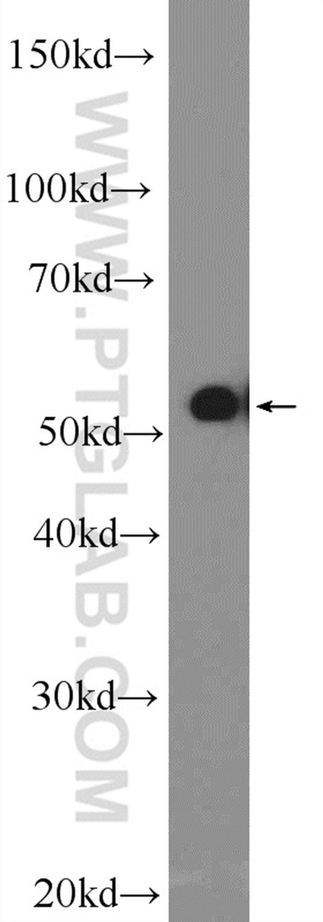 WASP Antibody in Western Blot (WB)