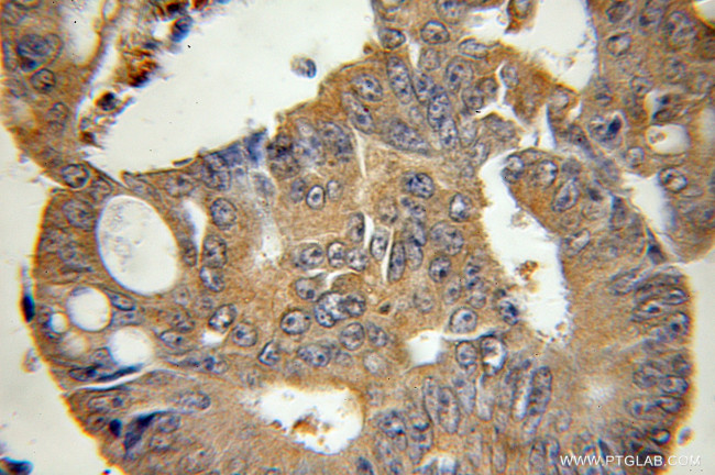 BID Antibody in Immunohistochemistry (Paraffin) (IHC (P))