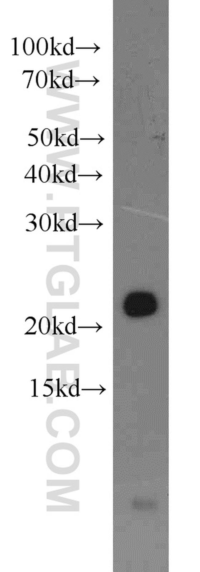 BID Antibody in Western Blot (WB)