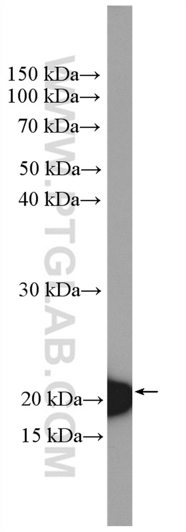 BID Antibody in Western Blot (WB)