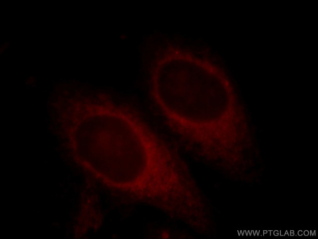 SKP1 Antibody in Immunocytochemistry (ICC/IF)