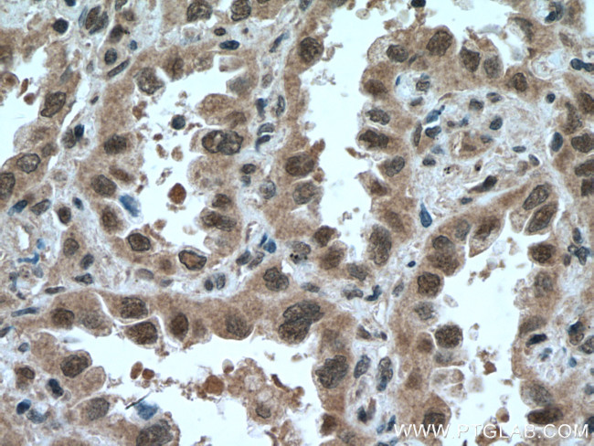 SKP1 Antibody in Immunohistochemistry (Paraffin) (IHC (P))