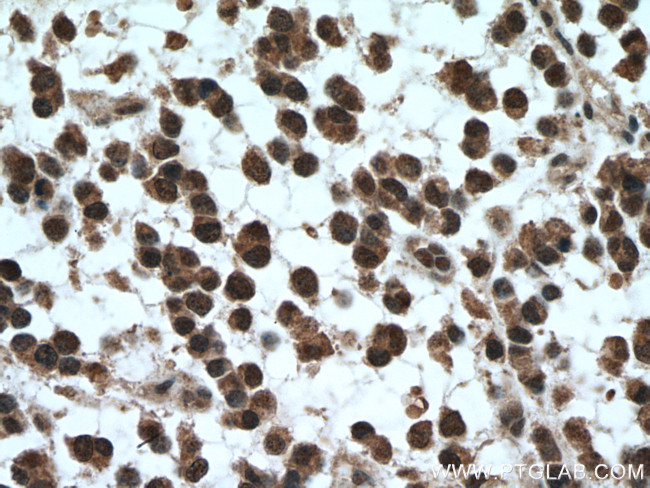 SKP1 Antibody in Immunohistochemistry (Paraffin) (IHC (P))