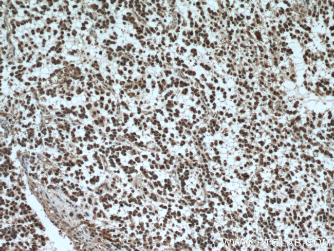 SKP1 Antibody in Immunohistochemistry (Paraffin) (IHC (P))