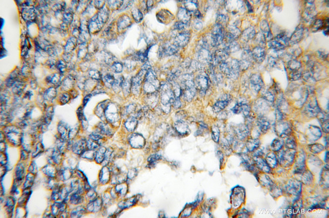 FHL1 Antibody in Immunohistochemistry (Paraffin) (IHC (P))