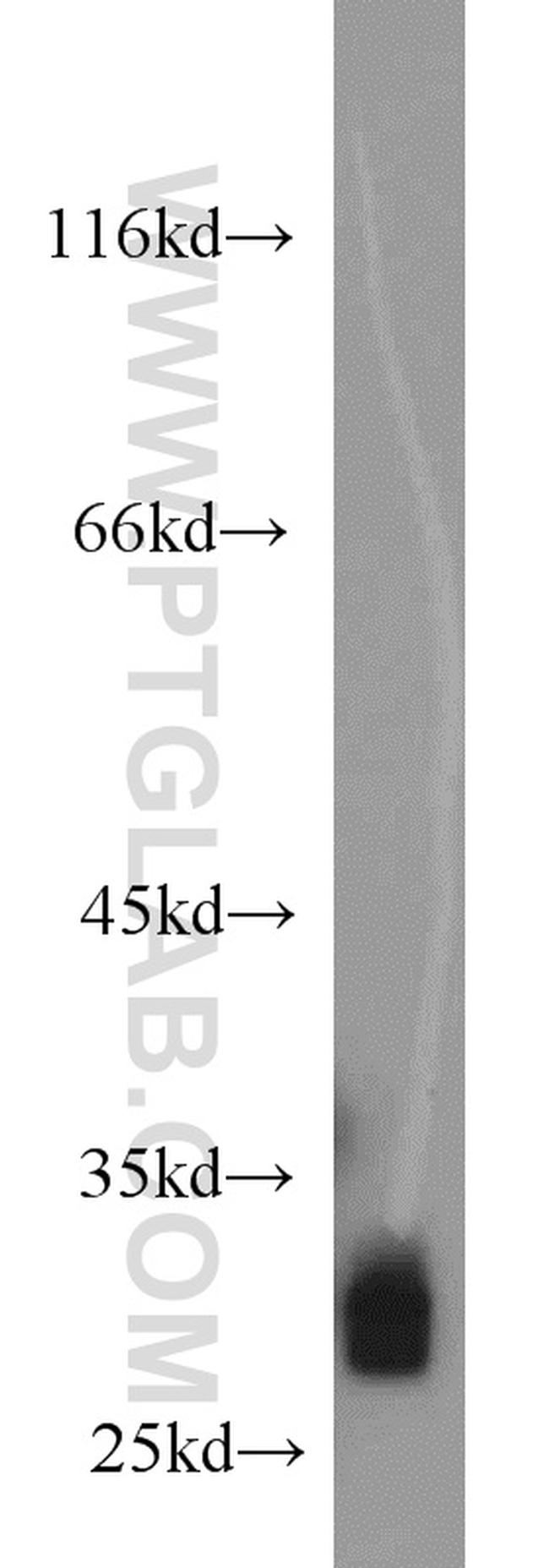 FHL1 Antibody in Western Blot (WB)