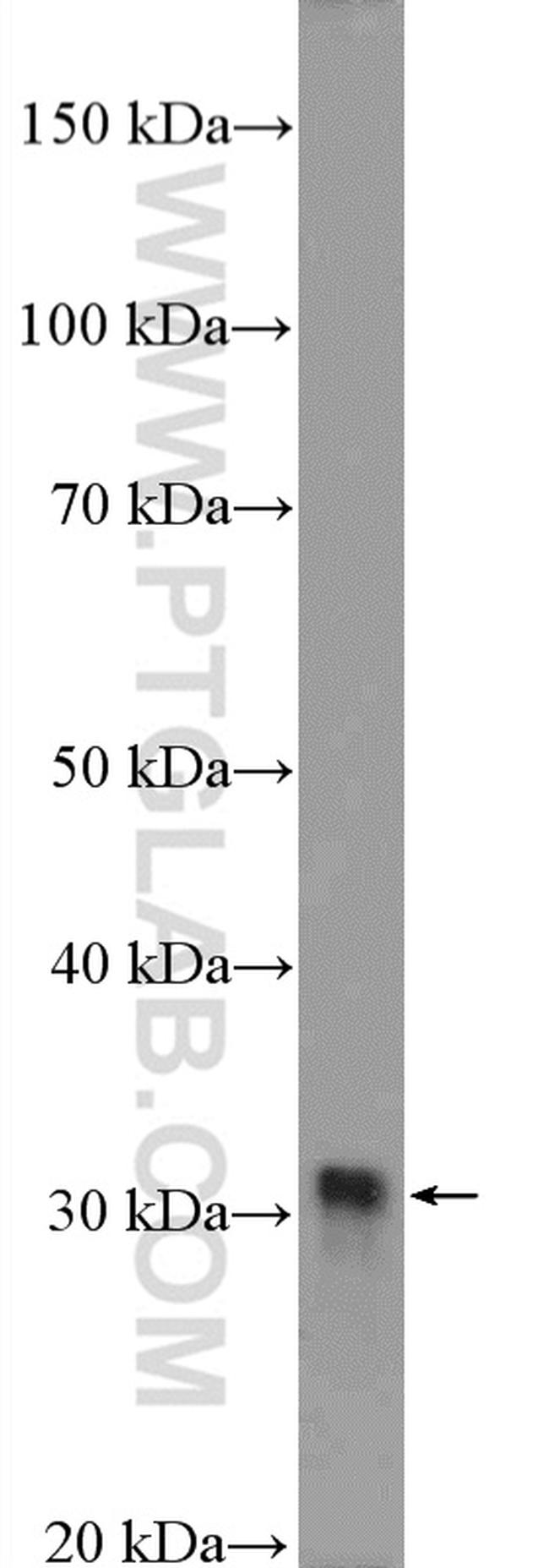 FHL1 Antibody in Western Blot (WB)
