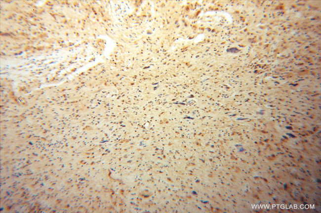 CSNK2A1 Antibody in Immunohistochemistry (Paraffin) (IHC (P))