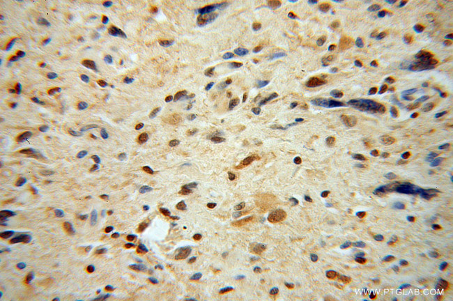 CSNK2A1 Antibody in Immunohistochemistry (Paraffin) (IHC (P))