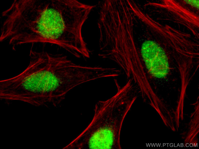 CSNK2A1 Antibody in Immunocytochemistry (ICC/IF)