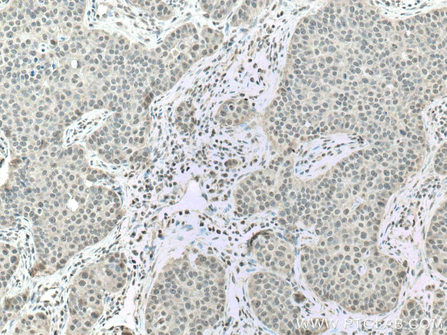 CSNK2A1 Antibody in Immunohistochemistry (Paraffin) (IHC (P))