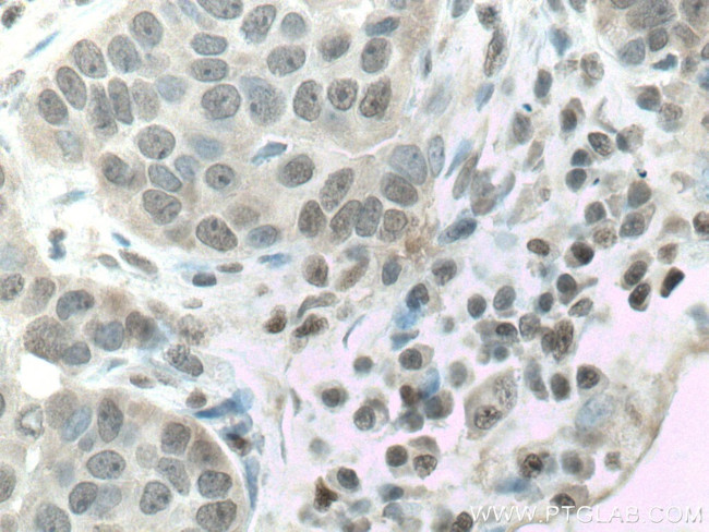 CSNK2A1 Antibody in Immunohistochemistry (Paraffin) (IHC (P))