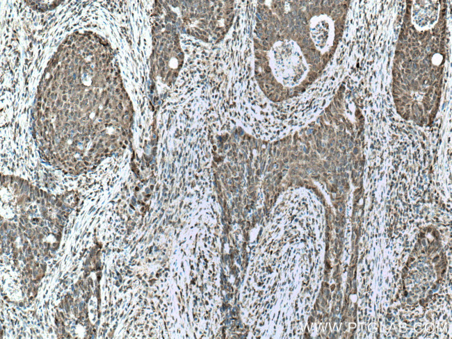 CSNK2A1 Antibody in Immunohistochemistry (Paraffin) (IHC (P))