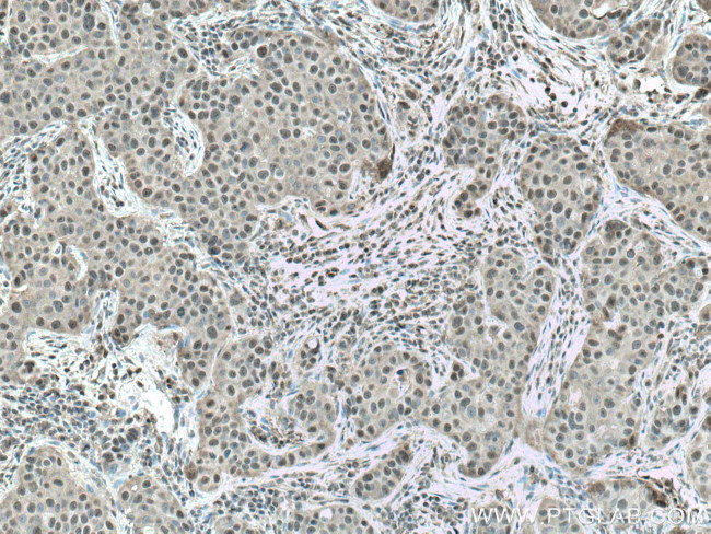 CSNK2A1 Antibody in Immunohistochemistry (Paraffin) (IHC (P))