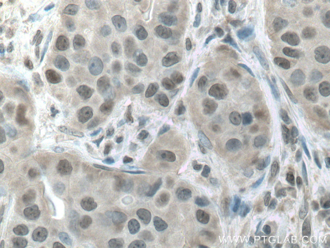 CSNK2A1 Antibody in Immunohistochemistry (Paraffin) (IHC (P))