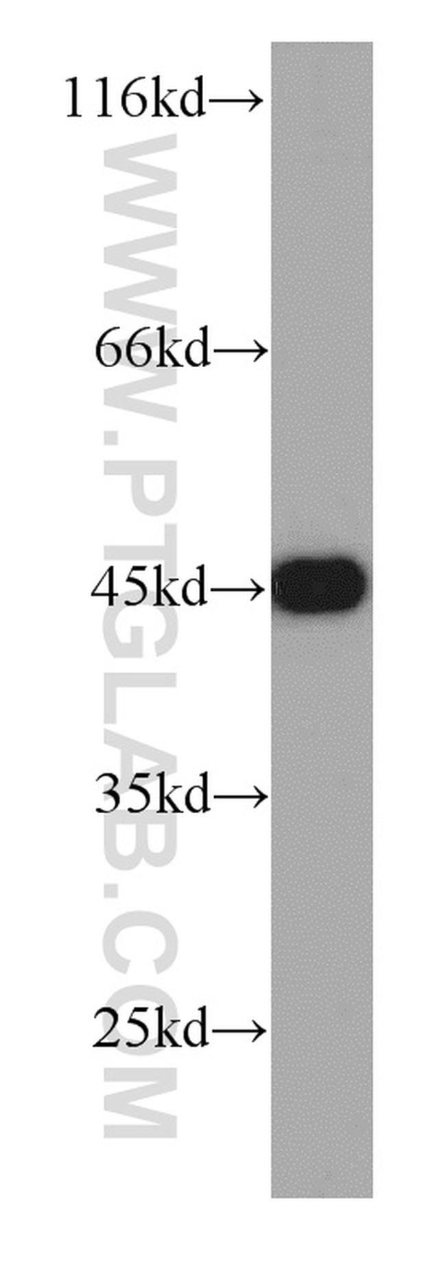 CSNK2A1 Antibody in Western Blot (WB)