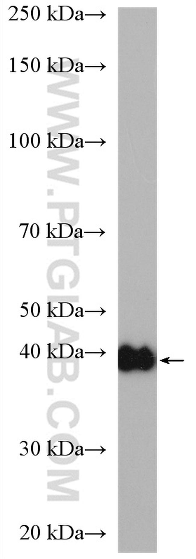 CSNK2A1 Antibody in Western Blot (WB)