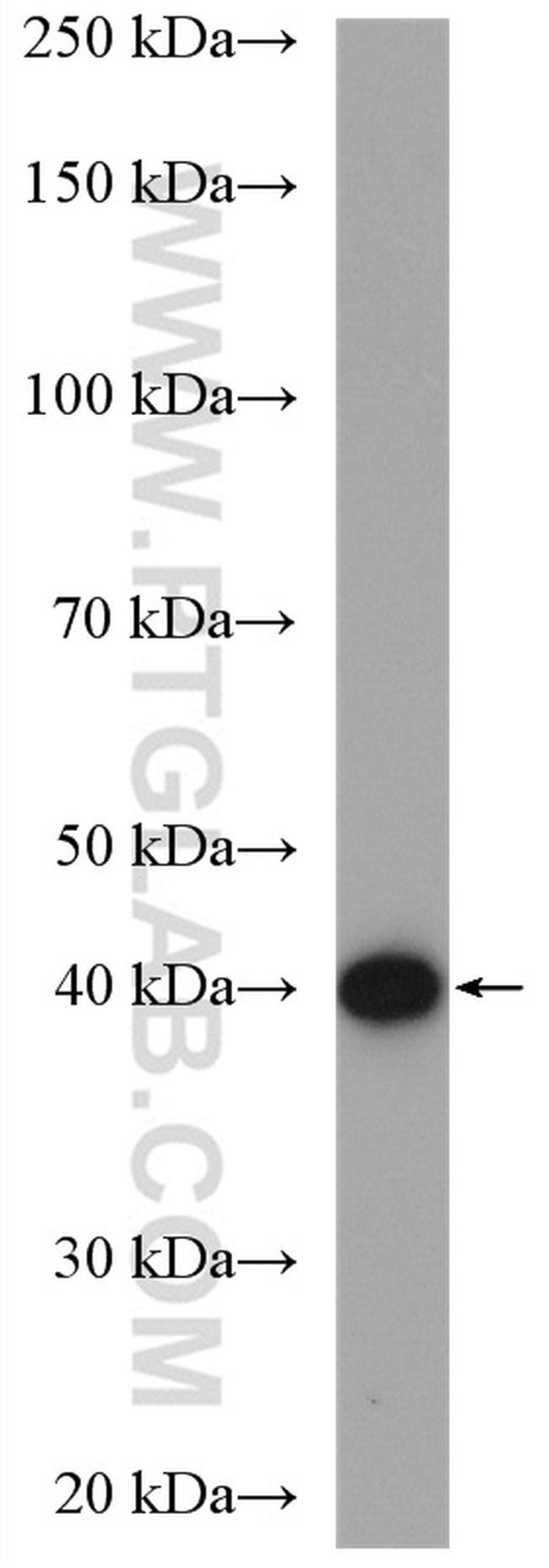 CSNK2A1 Antibody in Western Blot (WB)