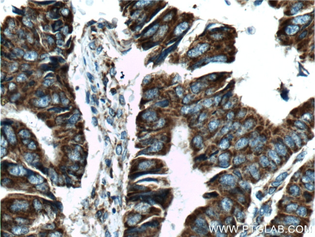 Cytochrome c Antibody in Immunohistochemistry (Paraffin) (IHC (P))