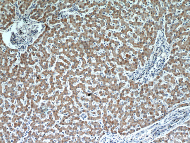 Cytochrome c Antibody in Immunohistochemistry (Paraffin) (IHC (P))